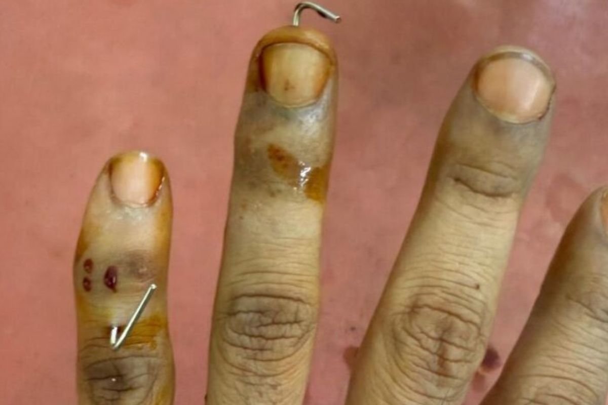 Army Major files FIR alleging assault, humiliation by senior officers at Cherry Blossom Festival.